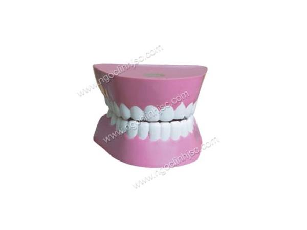 Mô hình hàm răng